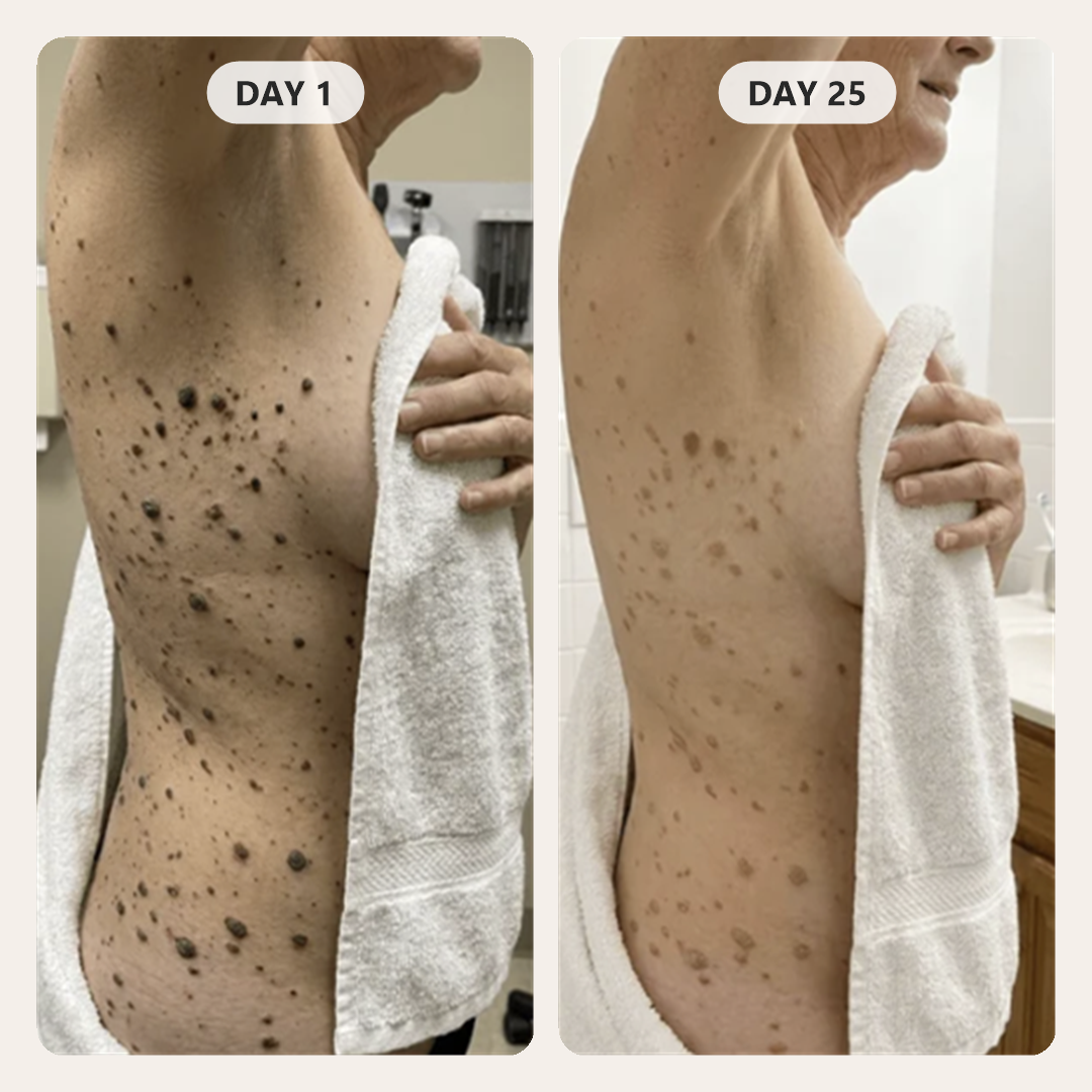 Customer's side and back on day 1 and day 25 of using Arcor